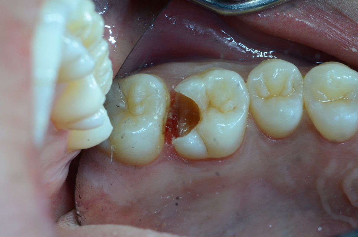 Conservative Dentistry Key West Family Dentistry